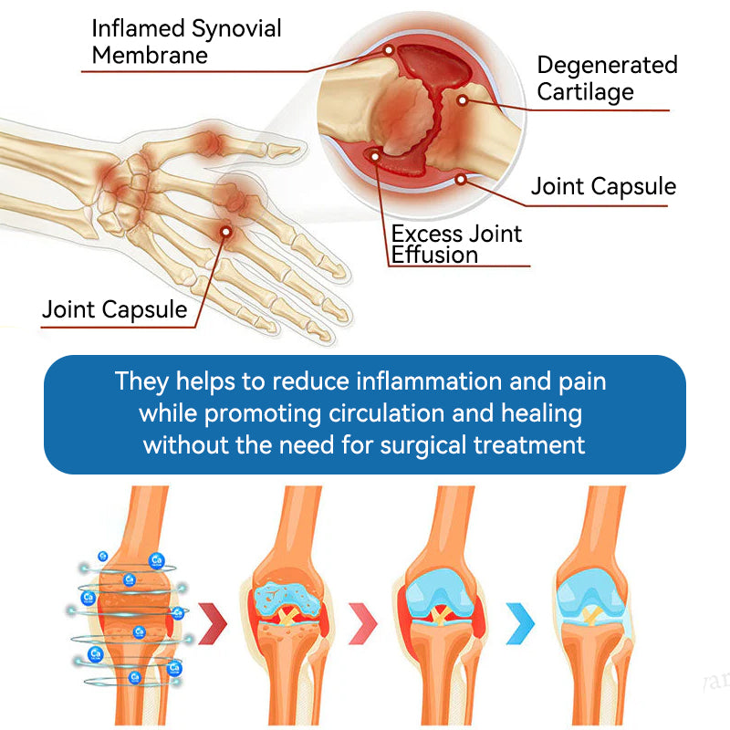 š¬š§šµNatravorĀ® ššš-ššš ššØš¢š§š šššš„š¢š§š  šš«ššš¦š¦“Treats Arthritis, Neuropathy, Rheumatism, Sports Injuries & Moreš