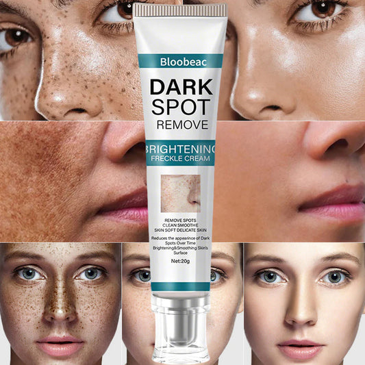 Blemish Removing Beauty Cream – Fades Dark Spots, Freckles & Wrinkles