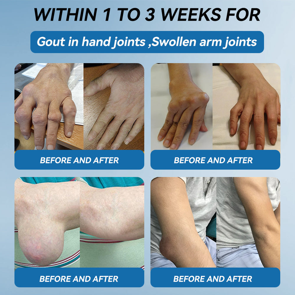 š¬š§šµNatravorĀ® ššš-ššš ššØš¢š§š šššš„š¢š§š  šš«ššš¦š¦“Treats Arthritis, Neuropathy, Rheumatism, Sports Injuries & Moreš
