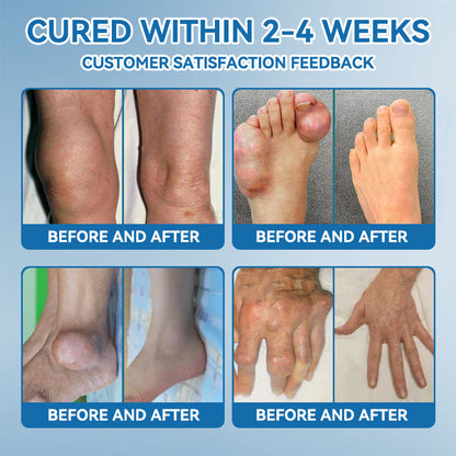 🇬🇧🌵Natravor® 𝐁𝐏𝐂-𝟏𝟓𝟕 𝐉𝐨𝐢𝐧𝐭 𝐇𝐞𝐚𝐥𝐢𝐧𝐠 𝐂𝐫𝐞𝐚𝐦🦴Treats Arthritis, Neuropathy, Rheumatism, Sports Injuries & More🏆