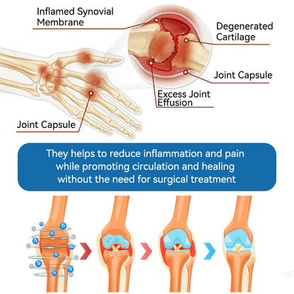 🇬🇧🌵Natravor® 𝐁𝐏𝐂-𝟏𝟓𝟕 𝐉𝐨𝐢𝐧𝐭 𝐇𝐞𝐚𝐥𝐢𝐧𝐠 𝐂𝐫𝐞𝐚𝐦🦴Treats Arthritis, Neuropathy, Rheumatism, Sports Injuries & More🏆