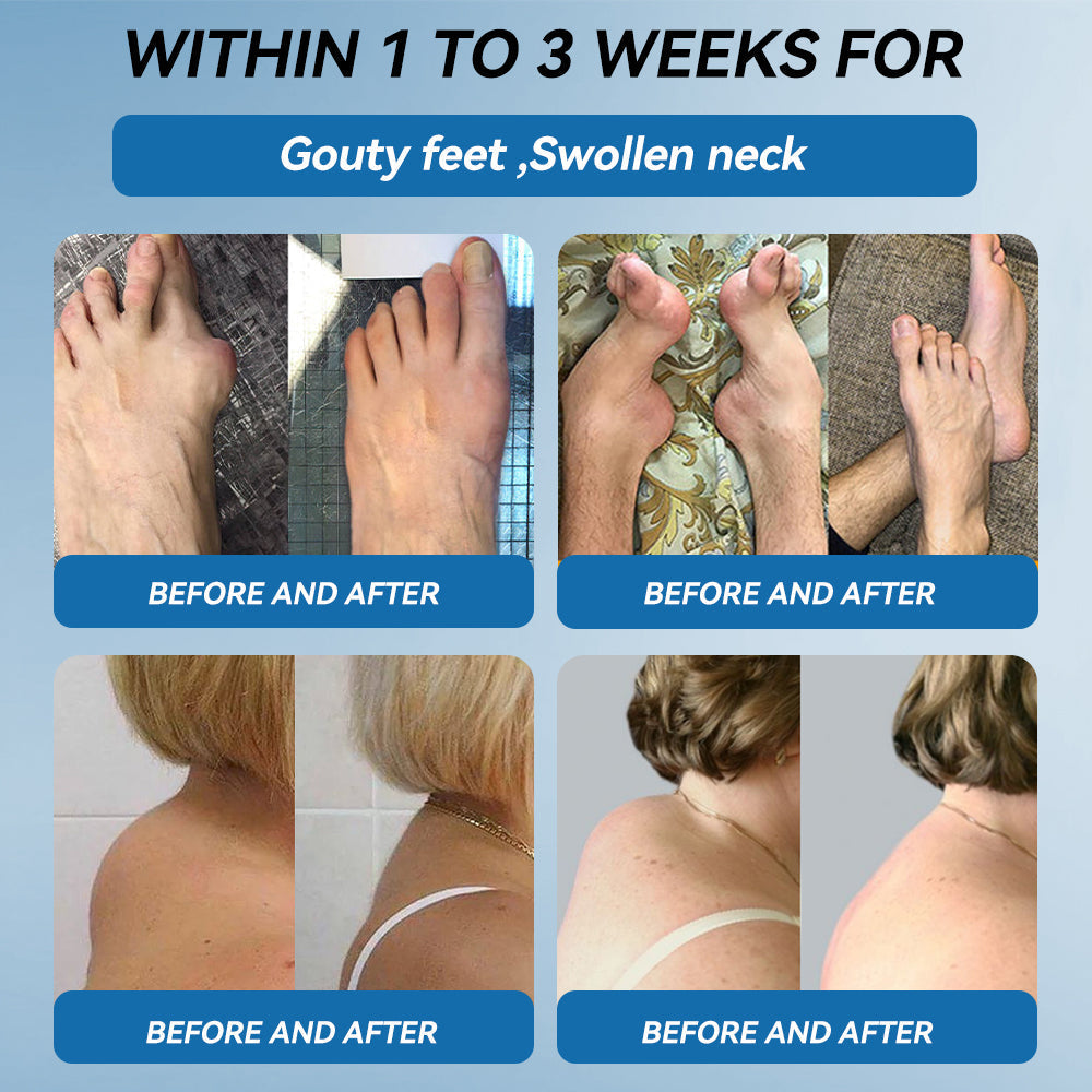 🇬🇧🌵Natravor® 𝐁𝐏𝐂-𝟏𝟓𝟕 𝐉𝐨𝐢𝐧𝐭 𝐇𝐞𝐚𝐥𝐢𝐧𝐠 𝐂𝐫𝐞𝐚𝐦🦴Treats Arthritis, Neuropathy, Rheumatism, Sports Injuries & More🏆